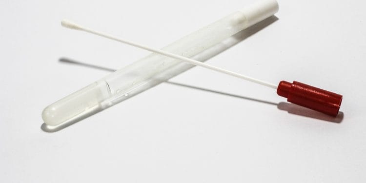 Минздрав: Массовое тестирование на коронавирус не требуется